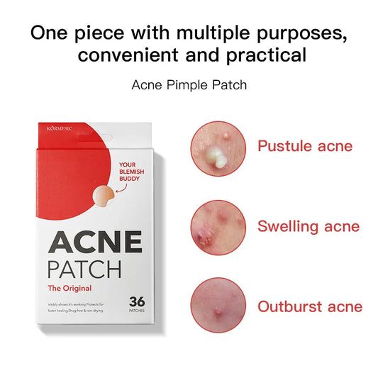 ZitZap Spot Stickers | Original Patch - Hydrocolloid Acne Pimple Patch for Covering Zits and Blemishes